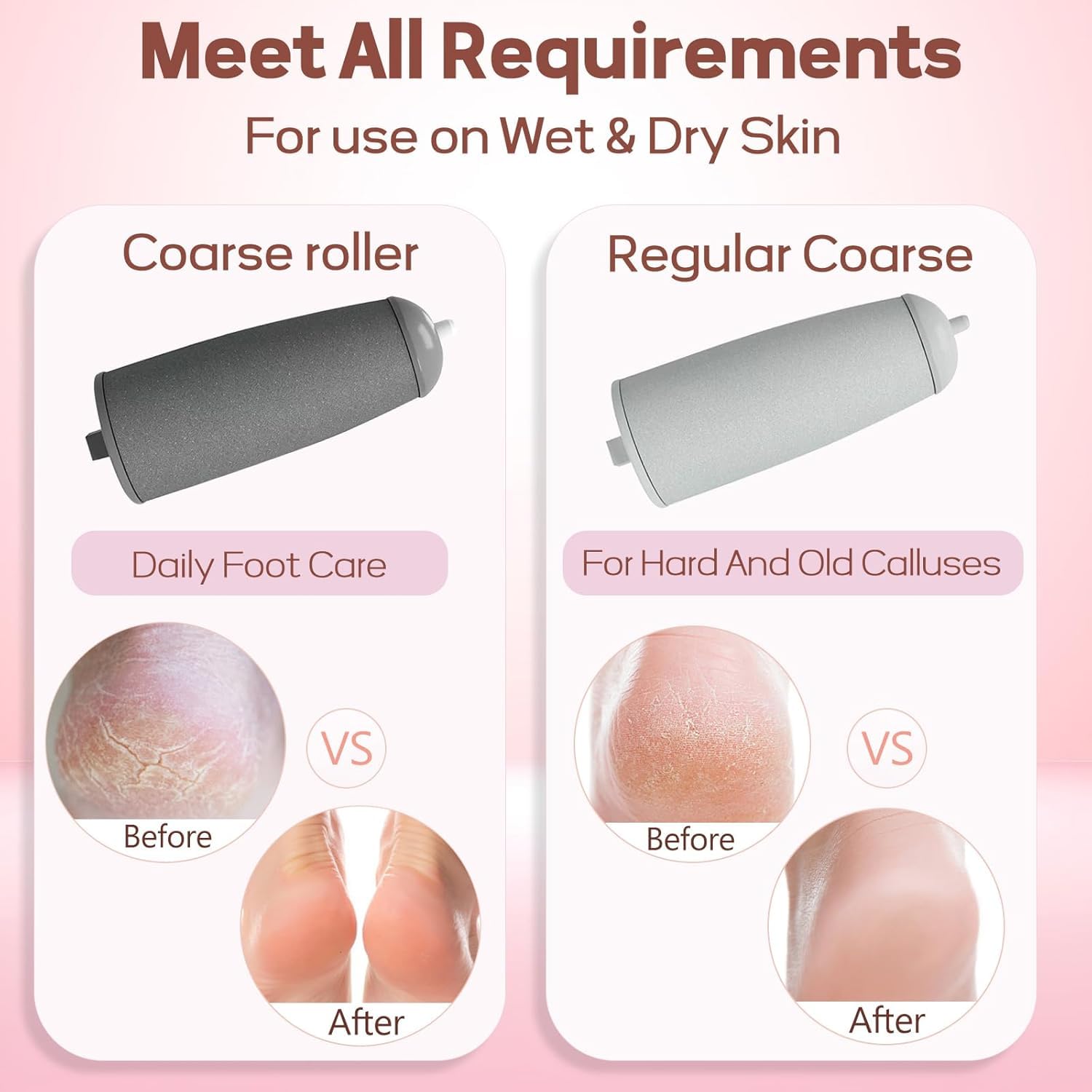 Pedicure Electric Foot Callus Remover